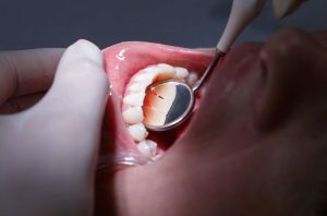 clinica dental tudela de duero